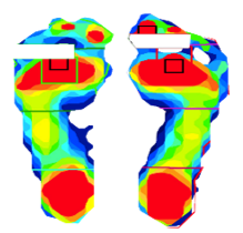 Forcemapping -FOOT足底壓力分布測試係統 Forcemapping -FOOT足(zú)底壓力分布測試係統